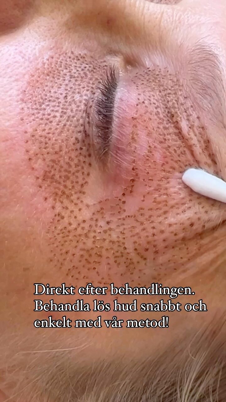 Instagram post from thetimelessclinic. This post is in position 19.