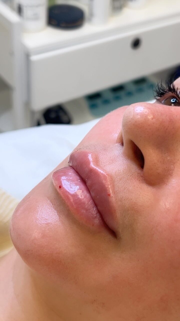 Instagram post from thetimelessclinic. This post is in position 14.