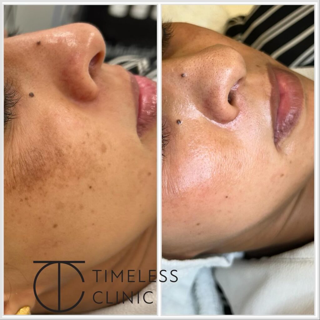 Instagram post from thetimelessclinic. This post is in position 1.