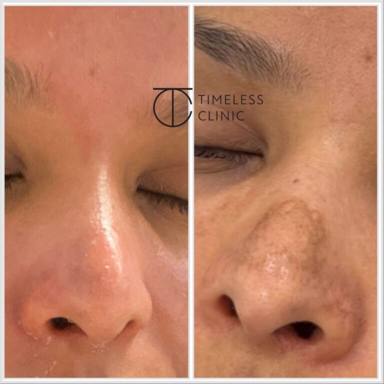 Instagram post from thetimelessclinic. This post is in position 2.