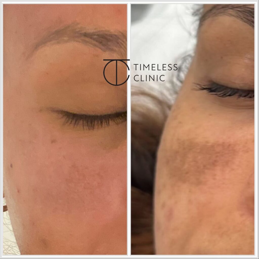 Instagram post from thetimelessclinic. This post is in position 1.