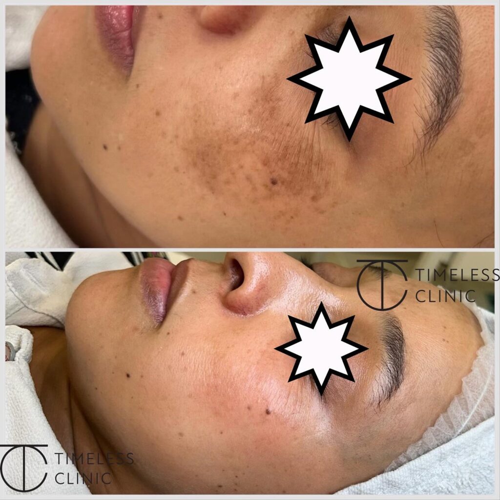 Instagram post from thetimelessclinic. This post is in position 0.