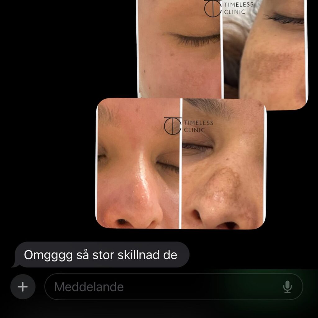 Instagram post from thetimelessclinic. This post is in position 2.