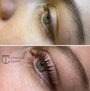 Före och efter lash lift-behandling – en jämförelse av naturliga fransar före behandlingen och resultatet med vackert böjda, fylliga fransar efteråt