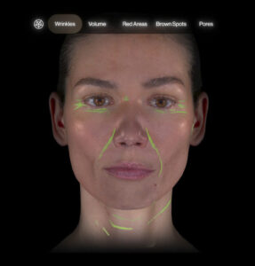 Wrinklesskin-analysis-978x1024